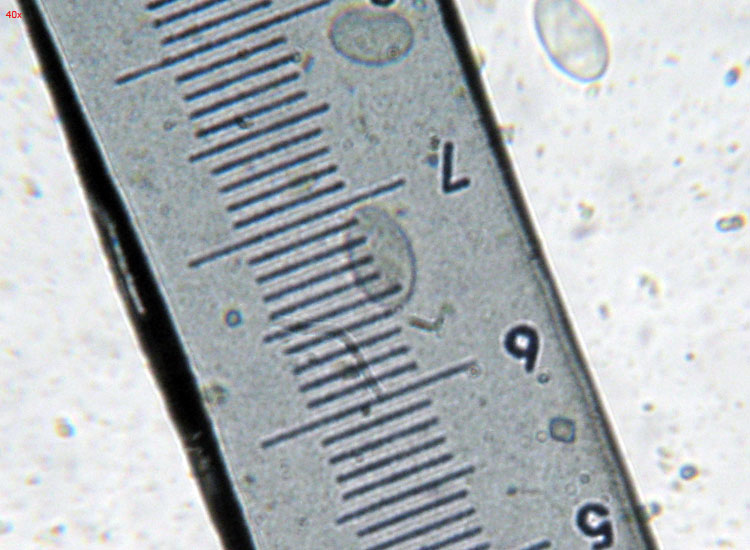 Su bruciato (cfr. Pyronema sp.)